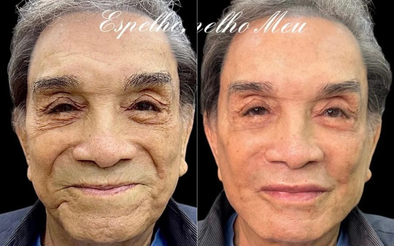 Antes e depois de Dedé Santana (Foto: Reprodução)
